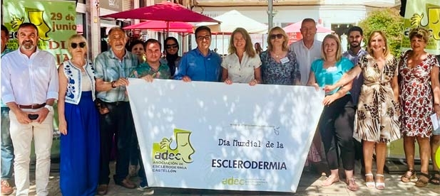Carrasco colabora con la Asociación de Esclerodermia Castellón